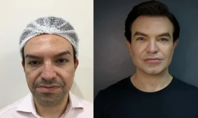 Ken Humano de SP revela rejuvenescimento anal e harmonização peniana: 'Não me arrependo'