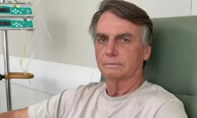 Relatório Médico Indica Cirurgia para Bolsonaro Devido a Dores e Limitações no Ombro Direito