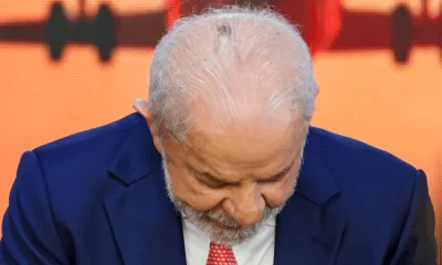Presidente Lula passará por duas cirurgias no Sírio-Libanês, em São Paulo, para tratar lesões de pele e tendinite no polegar