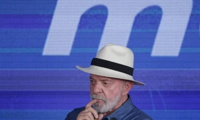 Lula passará por procedimentos médicos em São Paulo para tratar queratose e tendinite